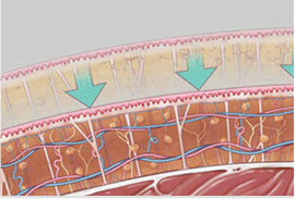 4. 繊維組織を保った状態のため 皮膚を引き締めます