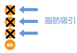 ダイエットと脂肪吸引の違い3