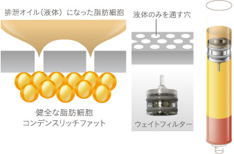 フィルタリング