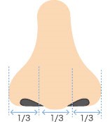 鼻尖手術とは…